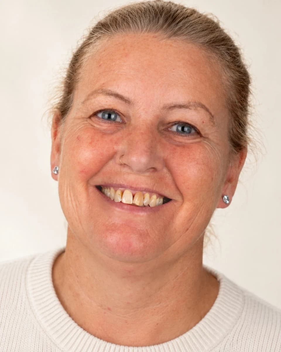 Before: A real Health Talia patient, 19 zirconia crowns. Only the studio light and backdrop were edited; her teeth and smile are from the original photos.